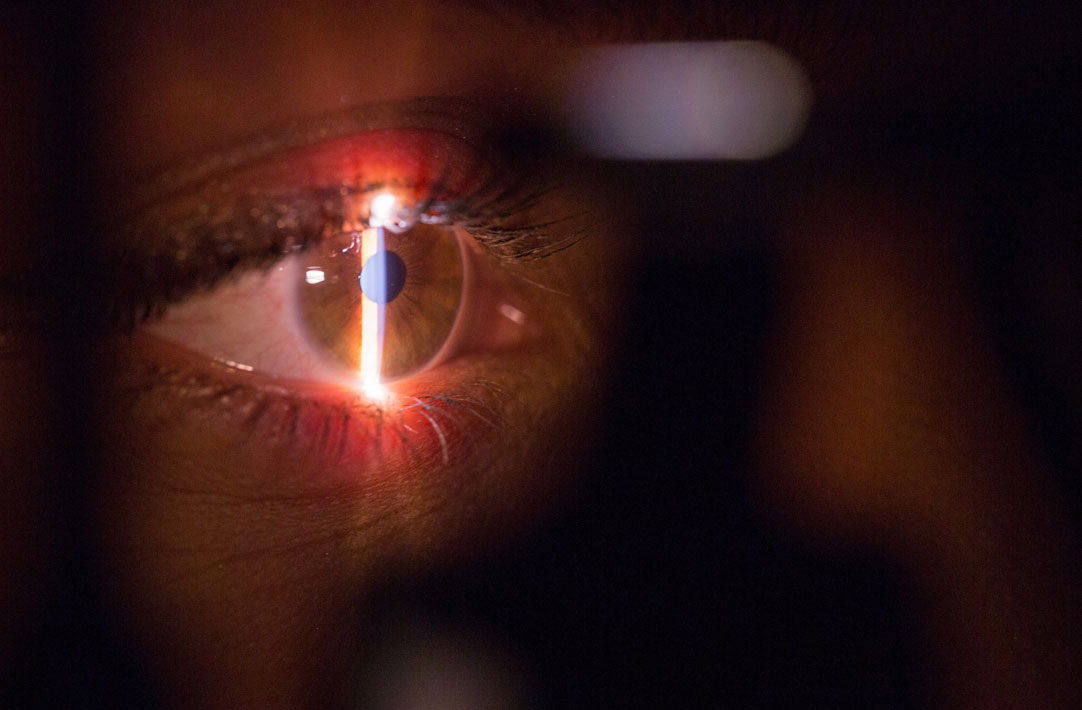 Closeup of laser eye
